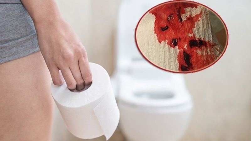 biến chứng của nứt kẽ hậu môn