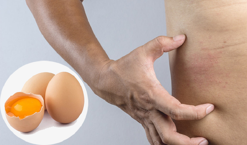 chữa đau dạ dày bằng trứng gà