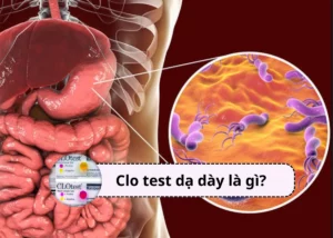 clo test dạ dày là gì