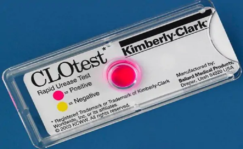 clo test dạ dày là gì