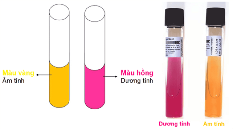 clo test dạ dày là gì