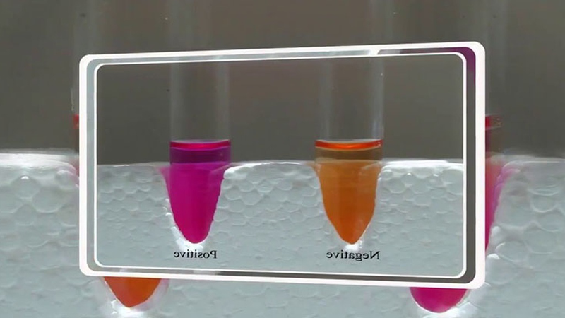 clo test dạ dày là gì