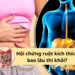 hội chứng ruột kích thích bao lâu thì khỏi
