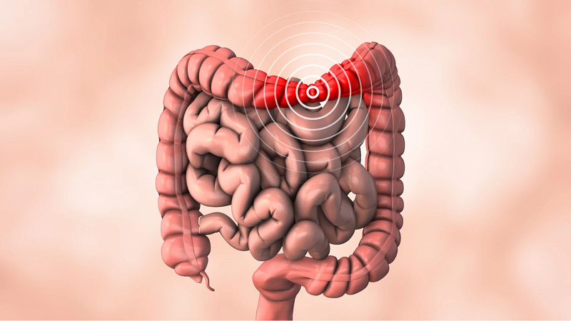 hội chứng ruột kích thích nên ăn gì