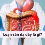 loạn sản dạ dày là gì