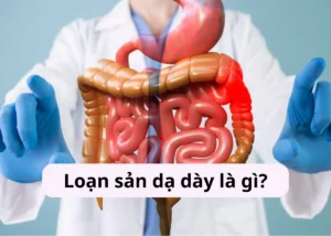 loạn sản dạ dày là gì