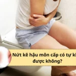 nứt kẽ hậu môn cấp