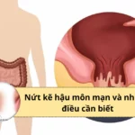 nứt kẽ hậu môn mạn