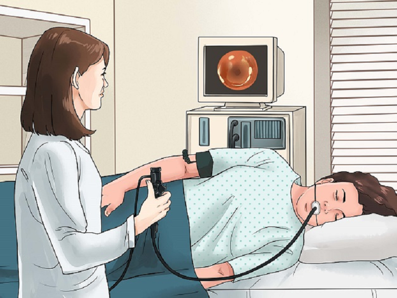viêm teo dạ dày c2