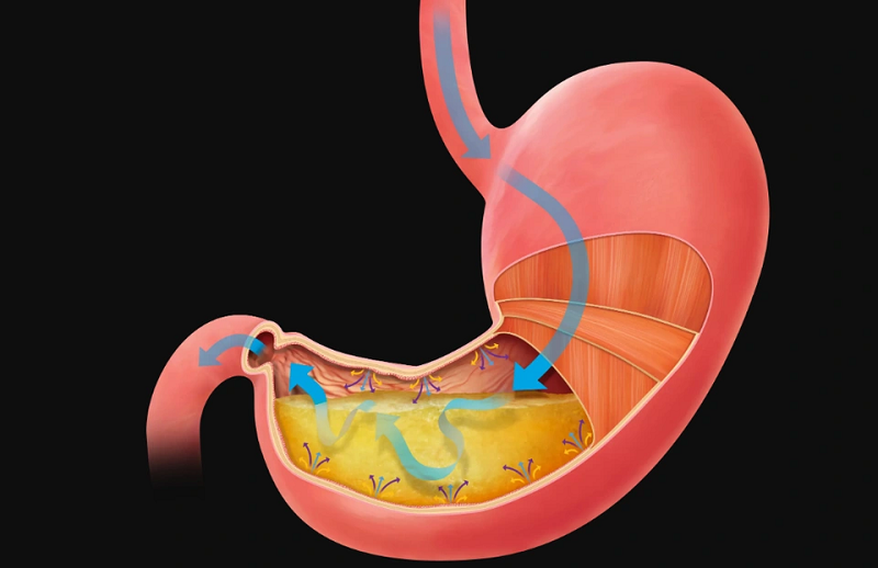 đau dạ dày có uống thuốc giảm cân được không