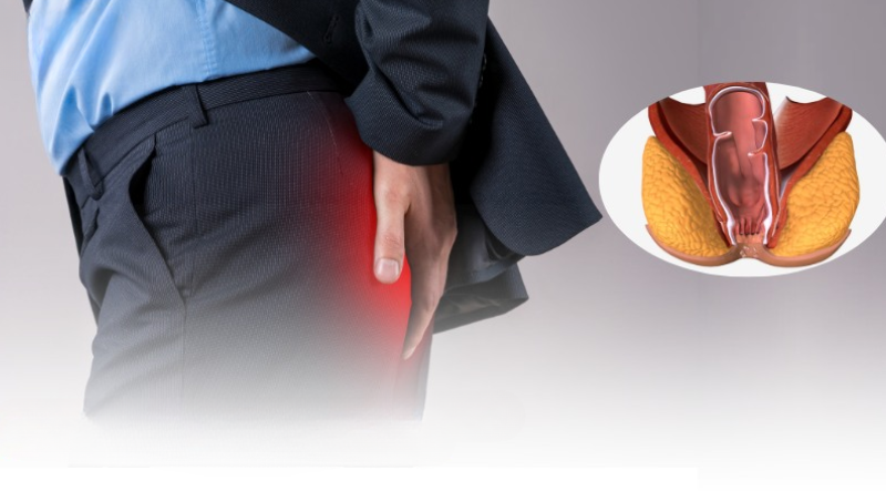 hẹp hậu môn sau mổ trĩ