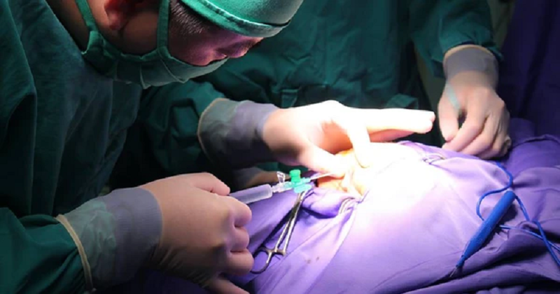 hẹp hậu môn sau mổ trĩ