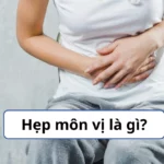 Hẹp môn vị là gì