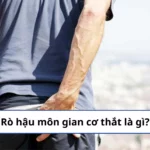 rò hậu môn gian cơ thắt là gì