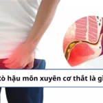 rò hậu môn xuyên cơ thắt