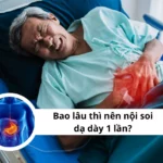 bao lâu thì nên nội soi dạ dày 1 lần