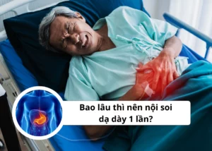 bao lâu thì nên nội soi dạ dày 1 lần