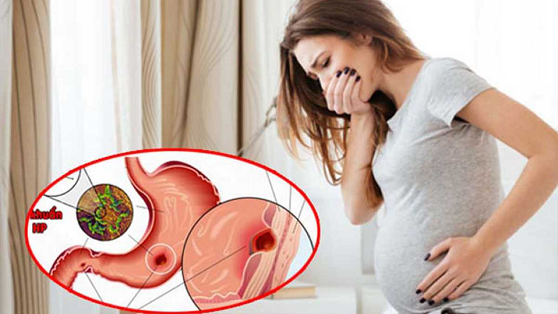 cách làm giảm đau dạ dày cho bà bầu