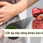 cắt dạ dày sống được bao lâu