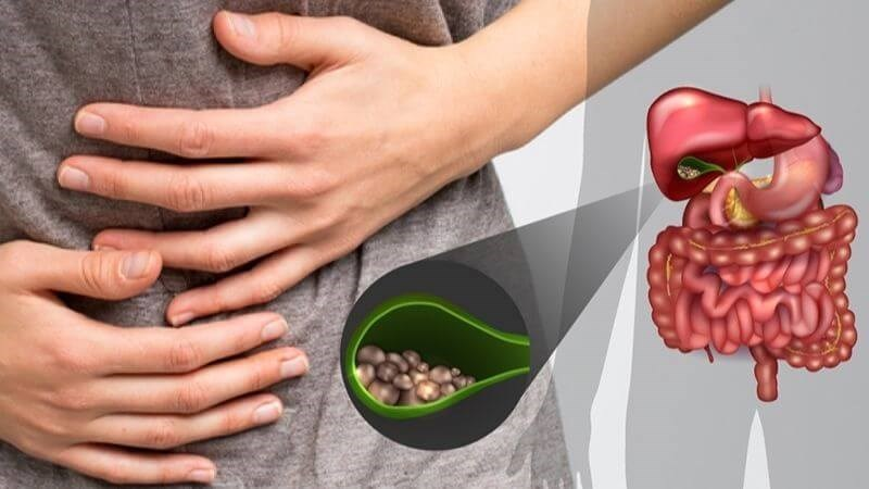 cắt dạ dày sống được bao lâu