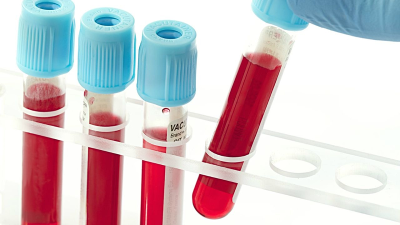 khám dạ dày không cần nội soi