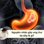 nguyên nhân gây ung thư dạ dày