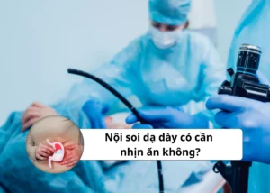 nội soi dạ dày có cần nhịn ăn không
