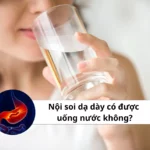 nội soi dạ dày có được uống nước không
