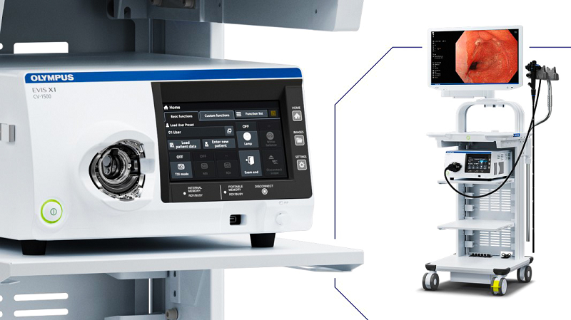 nội soi dạ dày ở đâu tốt nhất hà nội