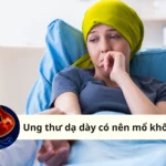 ung thư dạ dày có nên mổ không