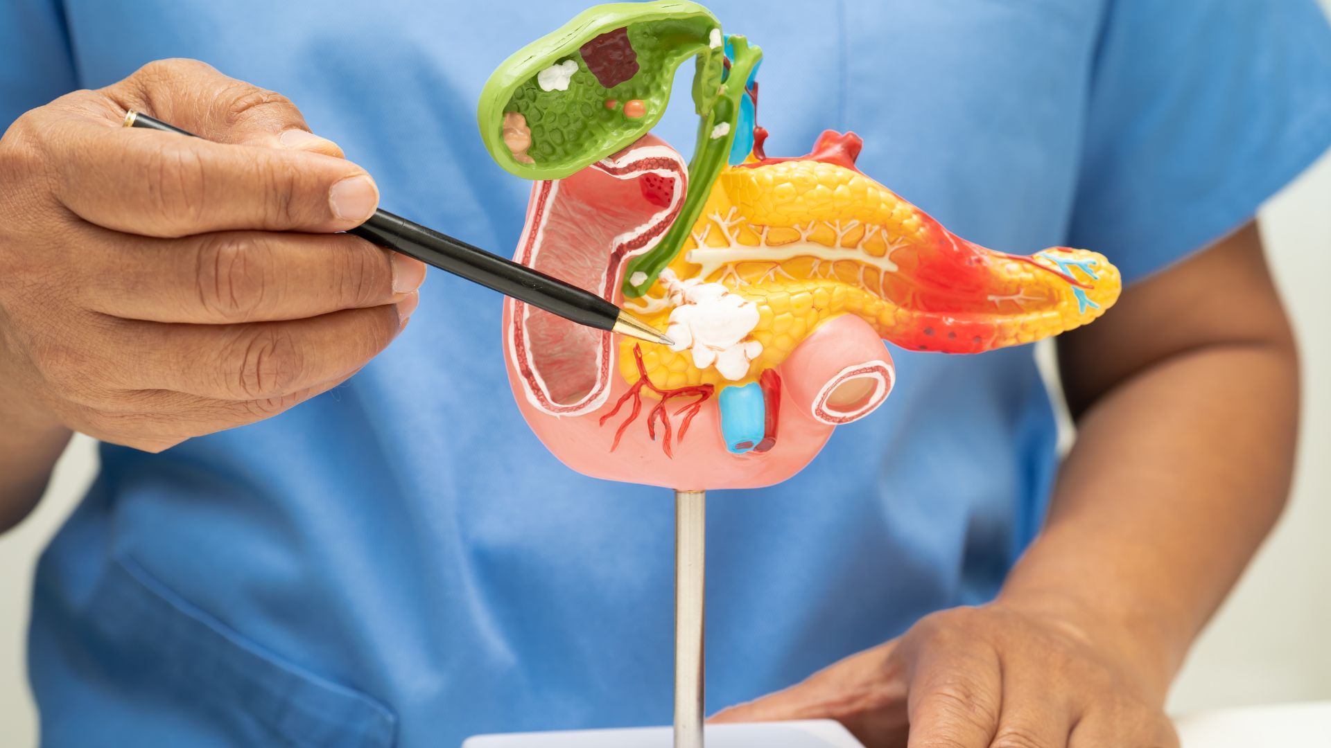 ung thư dạ dày có nên mổ không