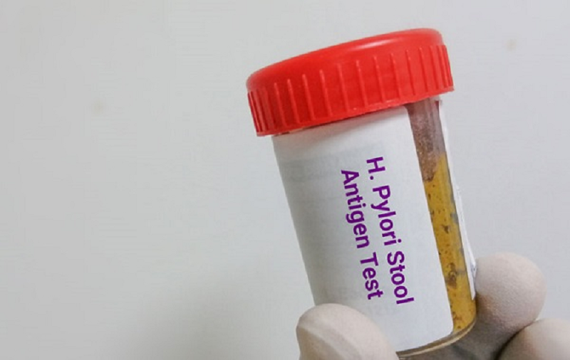 h pylori igg là gì