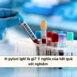 h pylori igm là gì