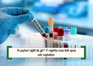 h pylori igm là gì
