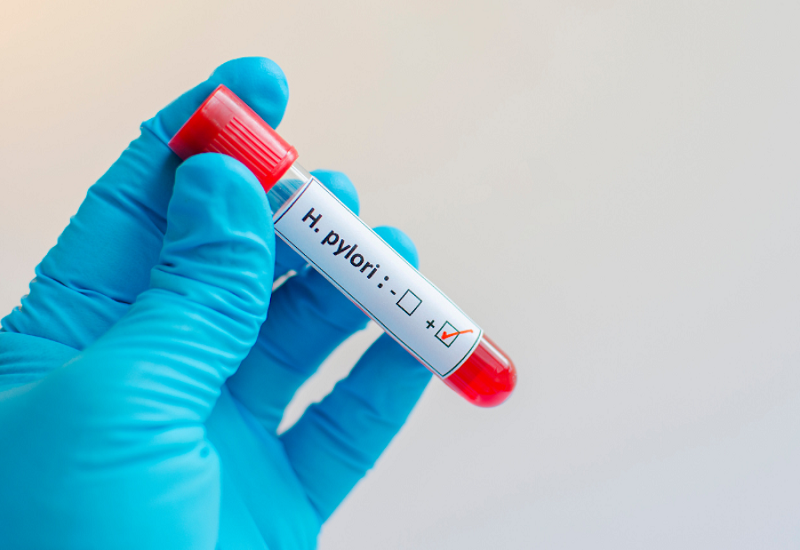 h pylori igm là gì