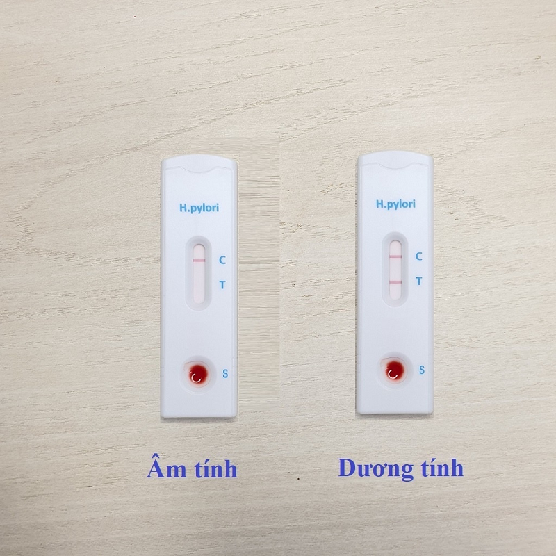 h pylori igm là gì