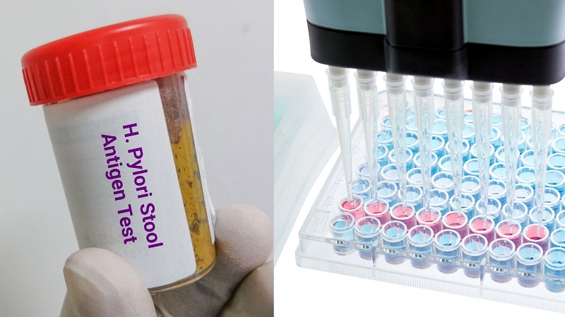 cách test vi khuẩn hp tại nhà