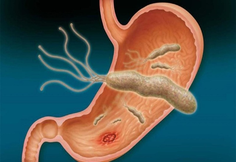 PPI gồm những thuốc nào