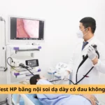 test hp bằng nội soi dạ dày