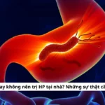 trị hp tại nhà