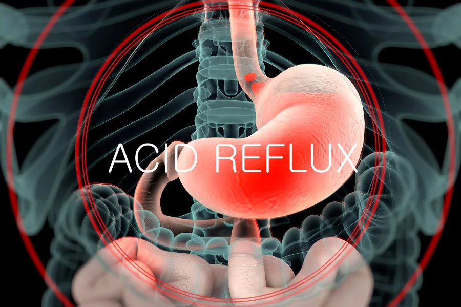 Nước ion kiềm có trung hòa acid dạ dày không?