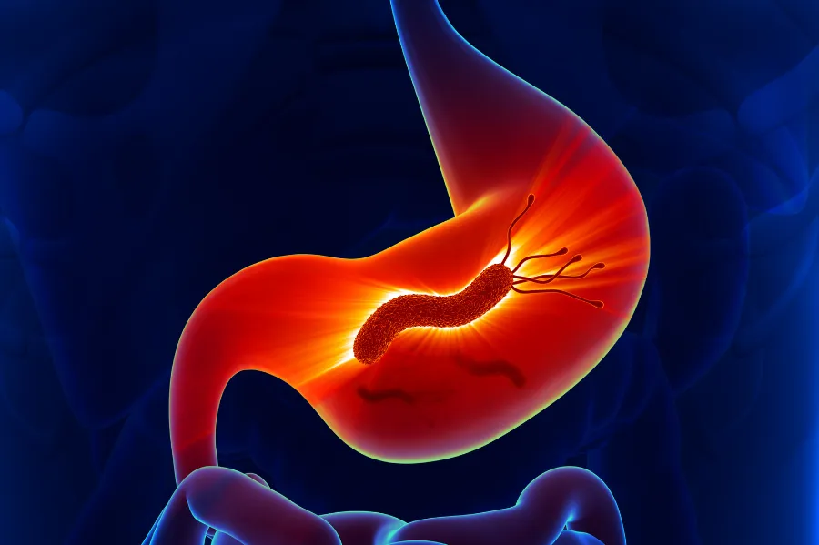 Nước ion kiềm có chữa viêm dạ dày hoặc viêm loét không?