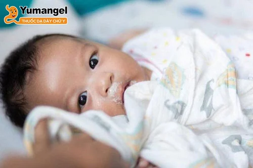 Trẻ sơ sinh bị trào ngược dạ dày thường bị nôn mửa, ọc sữa sau ăn. 