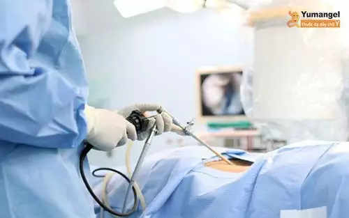 Phẫu thuật khâu nội soi thực quản sử dụng hệ thống Bard EndoCinch