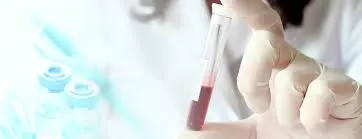 Xét nghiệm máu được sử dụng để đo kháng thể kháng H pylori. 