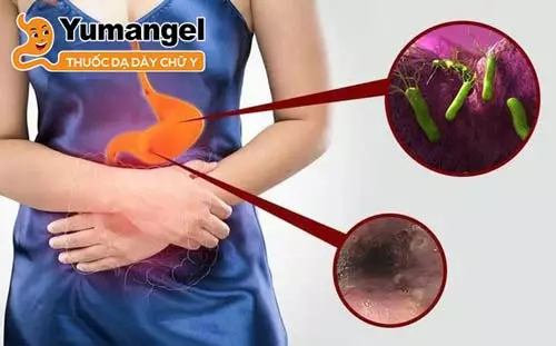 Viêm teo niêm mạc dạ dày C1 thường do vi khuẩn H.pylori.